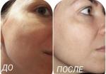 Альгинатная маска для лица O'CARE "Омоложение" фото