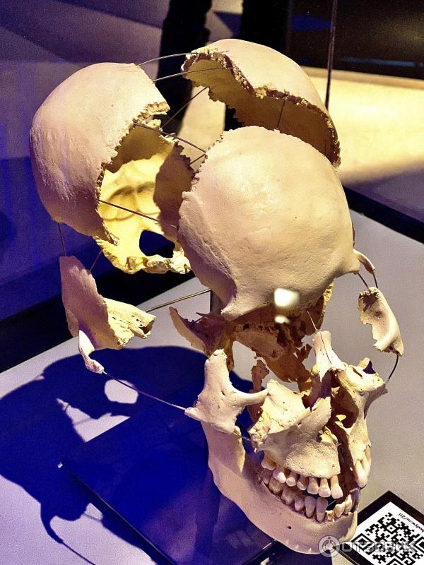 BODY WORLDS (Россия, Москва) фото