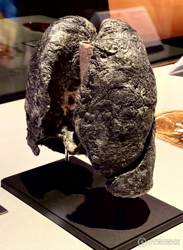 BODY WORLDS (Россия, Москва) фото