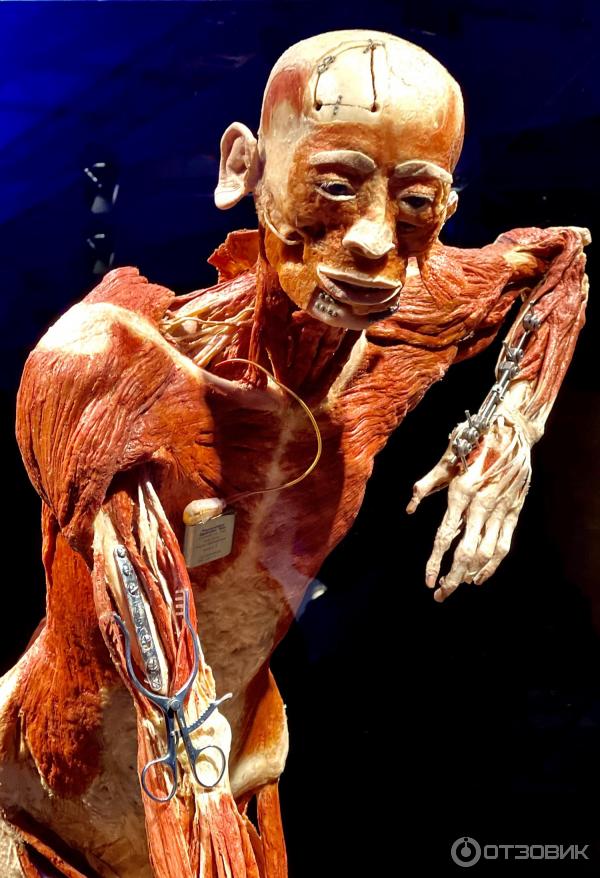 BODY WORLDS (Россия, Москва) фото