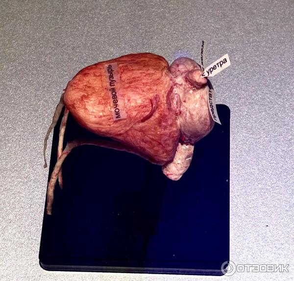 BODY WORLDS (Россия, Москва) фото