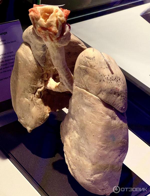 BODY WORLDS (Россия, Москва) фото