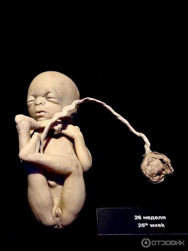 BODY WORLDS (Россия, Москва) фото