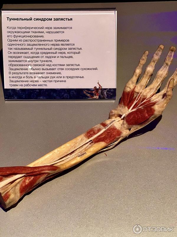 BODY WORLDS (Россия, Москва) фото