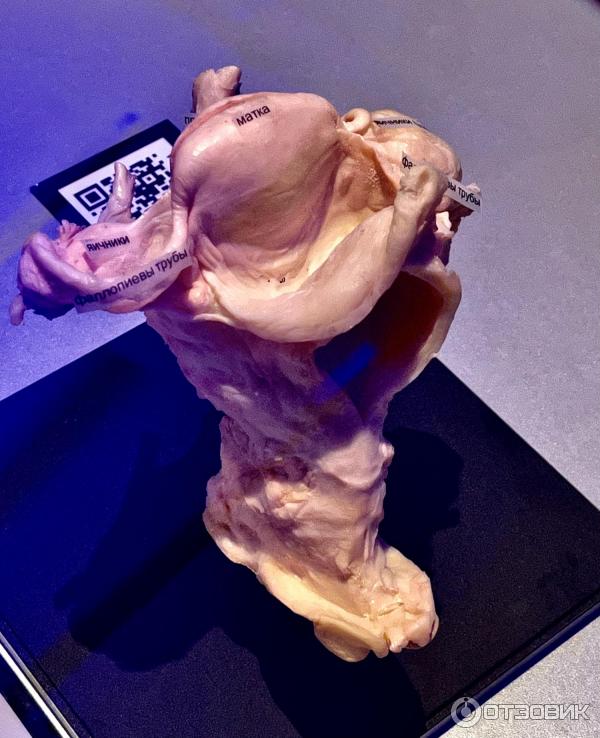 BODY WORLDS (Россия, Москва) фото