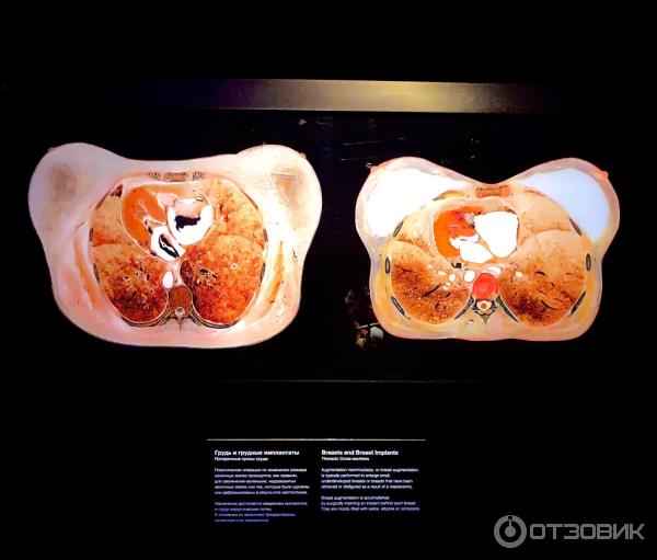 BODY WORLDS (Россия, Москва) фото