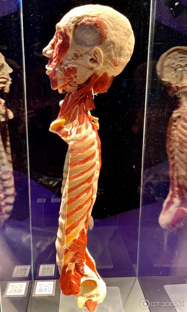 BODY WORLDS (Россия, Москва) фото