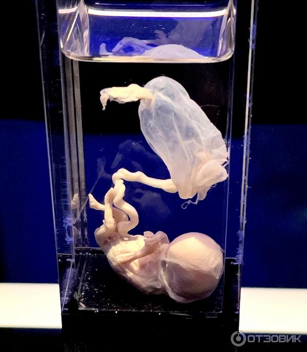 BODY WORLDS (Россия, Москва) фото