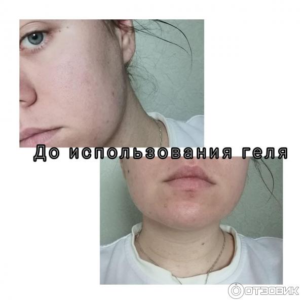 Гель для умывания Bioderma Sebium - Gel moussant purifiant фото