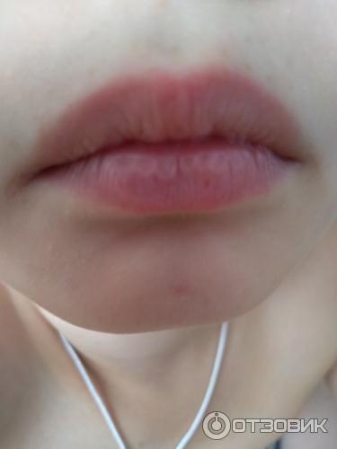 Мазь для наружного применения Фармпрепарат Стелланин фото