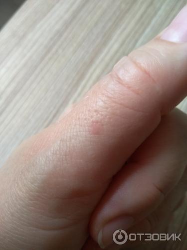 Кожа через неделю