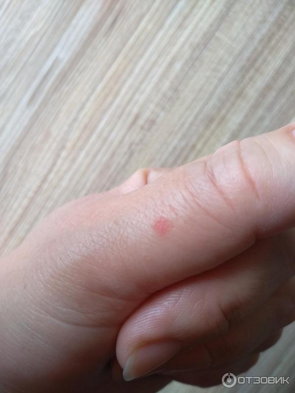 Рана на пальце