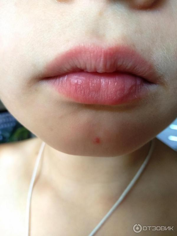 Мазь для наружного применения Фармпрепарат Стелланин фото