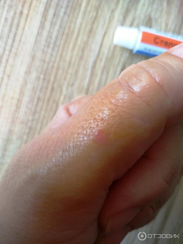 Мазь на коже