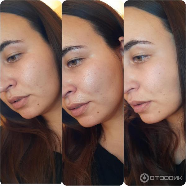 Пилинг aravia 18 anti acne peeling. Пилинг для проблемной кожи. Aravia пилинг для проблемной кожи с комплексом кислот 18% Anti-acne peeling.