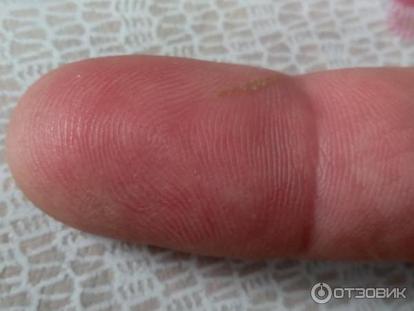 Отзыв о Мазь для наружного применения Фармпрепарат "Стелланин" | Чудо ...