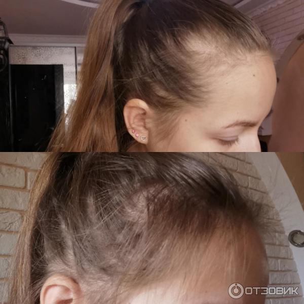 Тоник для волос Weleda Belebendes Haar-Tonikum фото